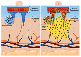 Graphical abstract: Novel SmartReservoirs for hydrogel-forming microneedles to improve the transdermal delivery of rifampicin