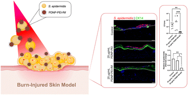 Graphical abstract: Antimicrobial and anti-inflammatory effects of polyethyleneimine-modified polydopamine nanoparticles on a burn-injured skin model