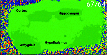 Graphical abstract: Zinc isotope ratio imaging of rat brain thin sections from stable isotope tracer studies by LA-MC-ICP-MS